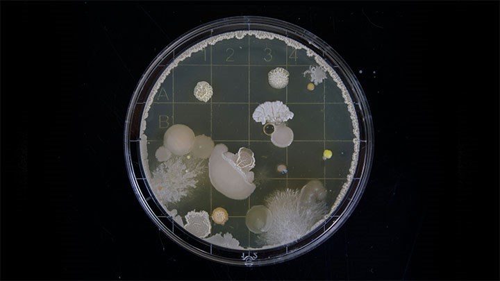 A Petri dish containing growing microscopic organisms with a green background.