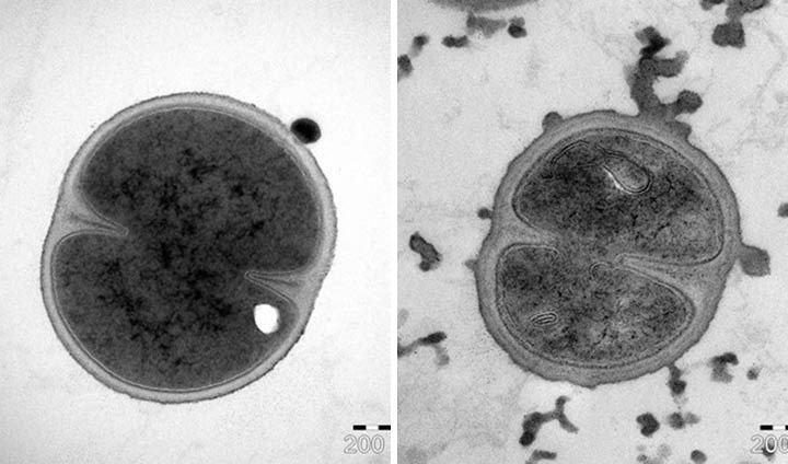 Bacteria before and after treatment