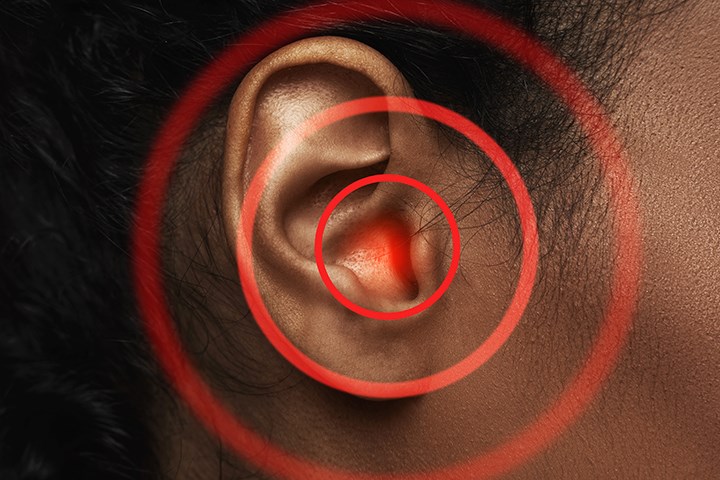 Närbild av kvinnans öra, röda cirklar - symboliserar tinnitus