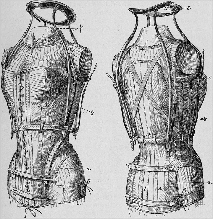 Medicinsk korsett 1800-talet