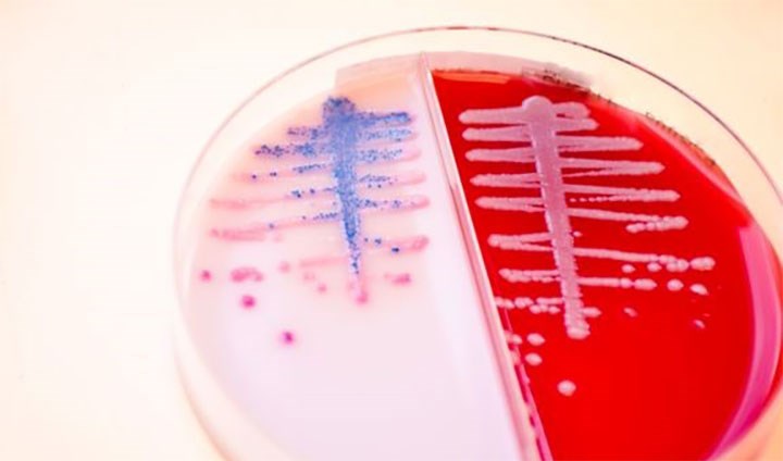 Urinodling där det växer E. coli.