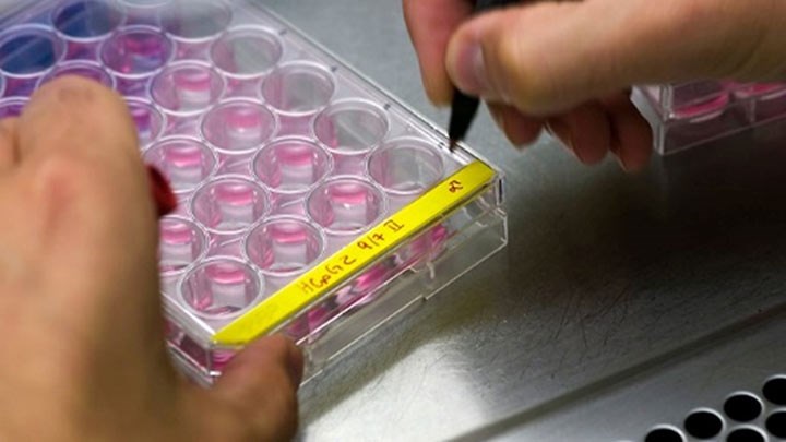 Manual marking of samples