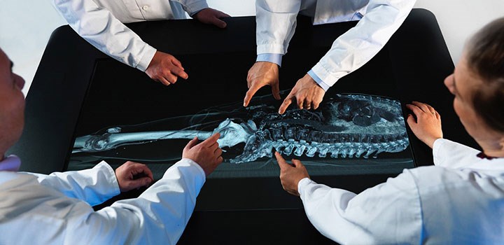 Några personer tittar på en röntgenbild av en ryggrad.
